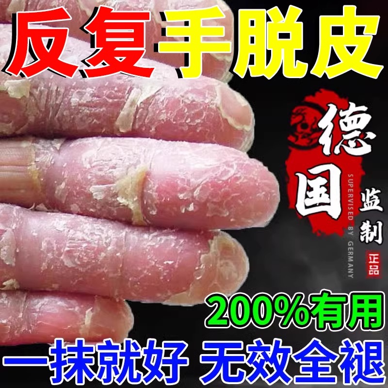 手脱皮严重脱皮专用治疗真菌蜕皮儿童手脚干燥起皮掉皮补维生素膏
