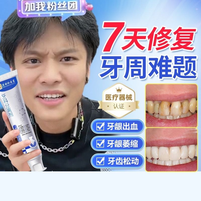 李时珍牙科分离剂牙膏治牙周炎口腔牙龈萎缩修复牙齿敏旗舰店正品